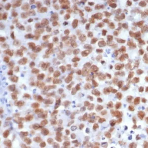 SALL-4 Antibody in Immunohistochemistry (IHC (P))
