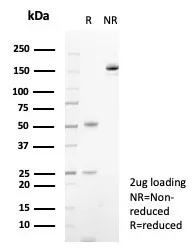 SDS-PAGE Analysis of Purified S100A14 Mouse Monoclonal Antibody (S100A14/7401). Confirmation of Purity and Integrity of Antibody.