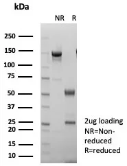 SDS-PAGE Analysis of Purified S100A14 Mouse Monoclonal Antibody (S100A14/7403). Confirmation of Purity and Integrity of Antibody.