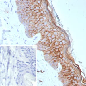 Formalin-fixed, paraffin-embedded human skin stained with S100A14 Recombinant Rabbit Monoclonal Antibody (S100A14/9077R). Inset: PBS instead of primary antibody; secondary only negative control.
