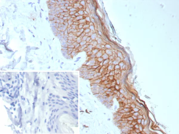 Formalin-fixed, paraffin-embedded human skin stained with S100A14 Recombinant Rabbit Monoclonal Antibody (S100A14/9077R). Inset: PBS instead of primary antibody; secondary only negative control.