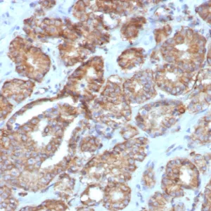 Formalin-fixed, paraffin-embedded human prostate stained with COX-2 Recombinant Rabbit Monoclonal Antibody (COX2/7803R). HIER: Tris/EDTA, pH9.0, 45min. 2: HRP-polymer, 30min. DAB, 5min.