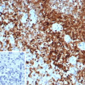 Formalin-fixed, paraffin-embedded human spleen stained with PTPN6 Mouse Monoclonal Antibody (PTPN6/7543). Inset: PBS instead of primary antibody; secondary only negative control.