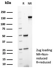 SDS-PAGE Analysis of Purified PTPN6 Mouse Monoclonal Antibody (PTPN6/7544) Confirmation of Purity and Integrity of Antibody.