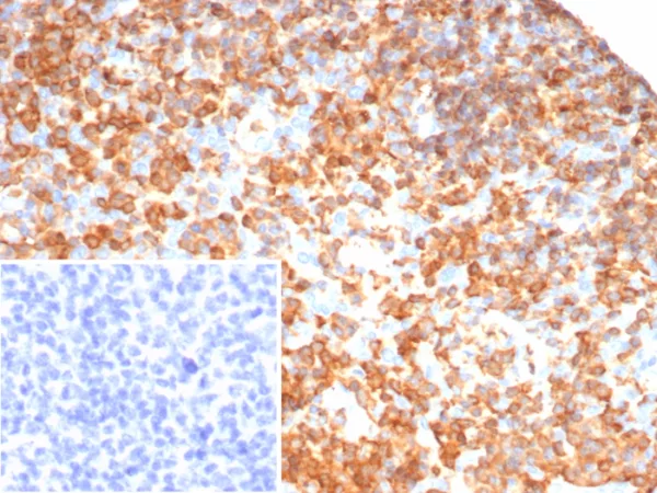 Formalin-fixed, paraffin-embedded human tonsil stained with PTPN6 Mouse Monoclonal Antibody (PTPN6/7544). Inset: PBS instead of primary antibody; secondary only negative control.