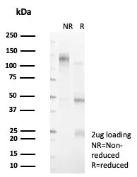SDS-PAGE Analysis of Purified KIAA1967 Mouse Monoclonal Antibody (PCRP-KIAA1967-1D10). Confirmation of Purity and Integrity of Antibody.