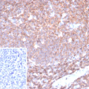Formalin-fixed, paraffin-embedded human tonsil stained with CD45 Mouse Monoclonal Antibody (PTPRC/6780). Inset: PBS instead of primary antibody; secondary only negative control.