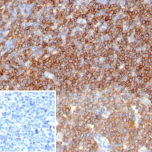 Formalin-fixed, paraffin-embedded human tonsil stained with CD45 Mouse Monoclonal Antibody (PTPRC/6862). Inset: PBS instead of primary antibody; secondary only negative control.