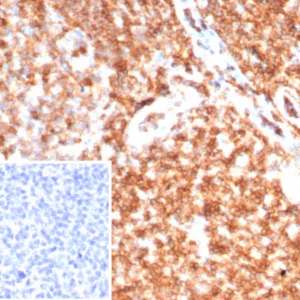 Formalin-fixed, paraffin-embedded human tonsil stained with CD45 Recombinant Mouse Monoclonal Antibody (rPTPRC/7275). Inset: PBS instead of primary antibody; secondary only negative control.