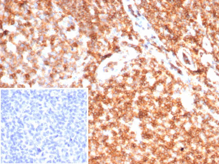 Formalin-fixed, paraffin-embedded human tonsil stained with CD45 Recombinant Mouse Monoclonal Antibody (rPTPRC/7275). Inset: PBS instead of primary antibody; secondary only negative control. Recombinant CD45 / LCA (B-Cell Marker) Antibody