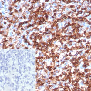 Recombinant CD45 / LCA (B-Cell Marker) Antibody