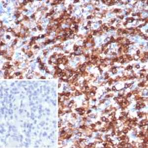 Formalin-fixed, paraffin-embedded human spleen stained with CD45 Recombinant Mouse Monoclonal Antibody (rPTPRC/1147). Inset: PBS instead of primary antibody; secondary only negative control.