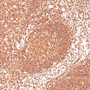 Formalin-fixed, paraffin-embedded human Tonsil stained with CD45 Mouse Monoclonal Antibody (2B11+PD7/26).