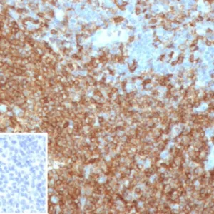 Formalin-fixed, paraffin-embedded human tonsil stained with CD45RA Recombinant Rabbit Monoclonal Antibody (PTPRC/4367R). Inset: PBS instead of primary antibody; secondary only negative control.