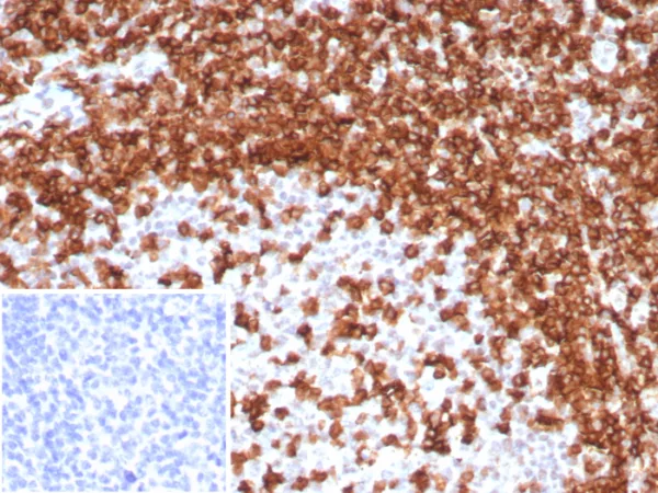Formalin-fixed, paraffin-embedded human tonsil stained with CD45RA Recombinant Rabbit Monoclonal Antibody (T200/8144R). Inset: PBS instead of primary antibody; secondary only negative control.