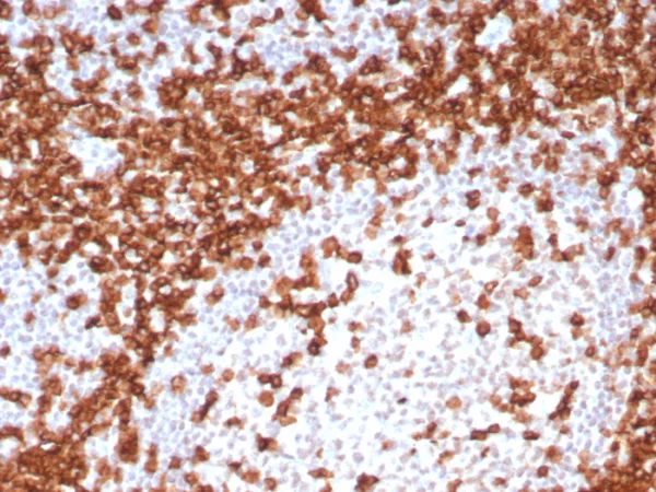Formalin-fixed, paraffin-embedded human tonsil stained with CD45RA Recombinant Rabbit Monoclonal Antibody (T200/8144R). HIER: Tris/EDTA, pH9.0, 45min. 2: HRP-polymer, 30min. DAB, 5min.