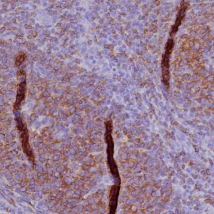 Formalin-fixed, paraffin-embedded human tonsil stained with CD45RA Recombinant Rabbit Monoclonal Antibody (PTPRC/8341R). HIER: Tris/EDTA, pH9.0, 45min. 2: HRP-polymer, 30min. DAB, 5min.