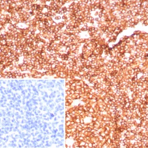 Formalin-fixed, paraffin-embedded human tonsil stained with CD45RA Recombinant Rabbit Monoclonal Antibody (PTPRC/8699R). Inset: PBS instead of primary antibody; secondary only negative control.