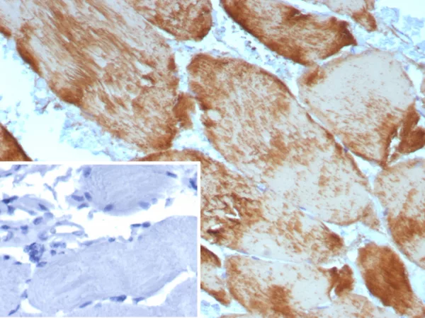 Formalin-fixed, paraffin-embedded human skeletal muscle stained with Skeletal Muscle Actin Recombinant Rabbit Monoclonal (ACTA1/9105R). Inset: PBS instead of primary antibody; secondary only negative control.