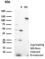 SDS-PAGE Analysis of Purified PVALB Mouse Monoclonal Antibody (PVALB/7601). Confirmation of Purity and Integrity of Antibody.