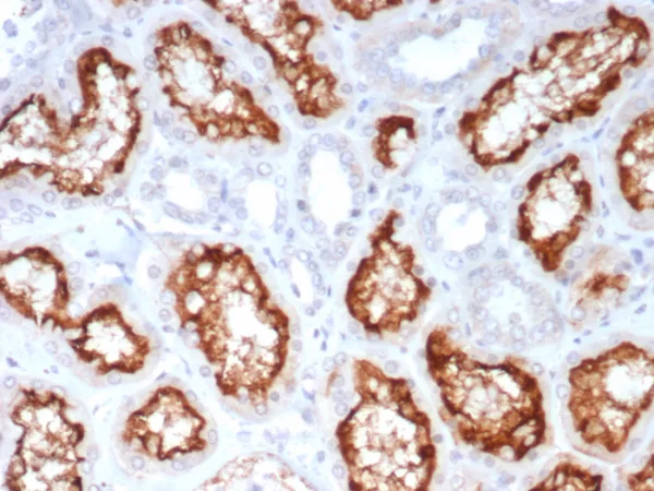 IHC analysis of formalin-fixed, paraffin-embedded human kidney. Stained using ACE2/7203 at 2ug/ml in PBS for 30min RT. HIER: Tris/EDTA, pH9.0, 45min. 2°C: HRP-polymer, 30min. DAB, 5min.