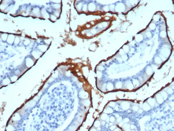 IHC analysis of formalin-fixed, paraffin-embedded human small intestine.  Stained using ACE2/7203 at 2ug/ml in PBS for 30min RT. HIER: Tris/EDTA, pH9.0, 45min. 2°C: HRP-polymer, 30min. DAB, 5min.
