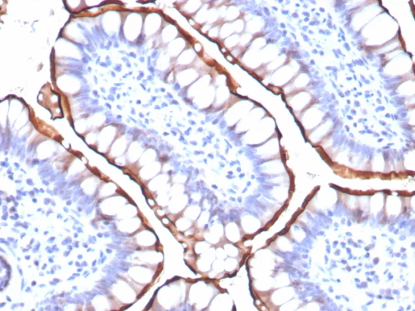 IHC analysis of formalin-fixed, paraffin-embedded human small intestine.  Stained using ACE2/8748R at 2ug/ml in PBS for 30min RT. HIER: Tris/EDTA, pH9.0, 45min. 2°C: HRP-polymer, 30min. DAB, 5min.