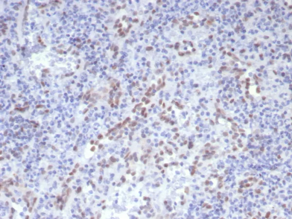 Formalin-fixed, paraffin-embedded human spleen stained Cyclin D1 Mouse Monoclonal Antibody (CCND1/7868). HIER: Tris/EDTA, pH9.0, 45min. 2°C: HRP-polymer, 30min. DAB, 5min.