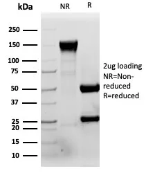 SDS-PAGE Analysis of Purified RBP4 Mouse Monoclonal Antibody (RBP4/4046). Confirmation of Purity and Integrity of Antibody.