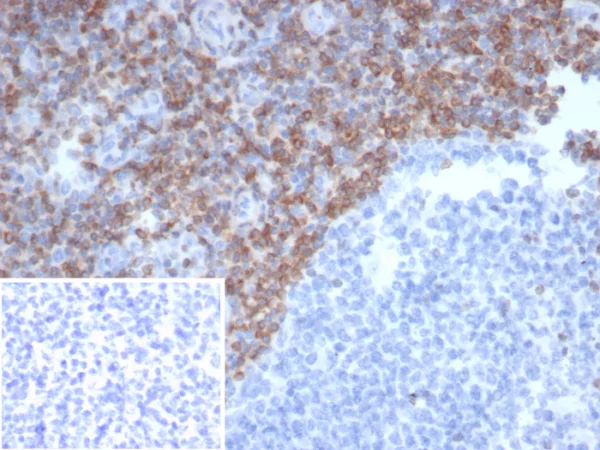 Formalin-fixed, paraffin-embedded human tonsil stained with  Bcl-2 Mouse Monoclonal Antibody (BCL2/6915). Inset: PBS instead of primary antibody; secondary only negative control.
