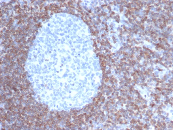 Formalin-fixed, paraffin-embedded human tonsil stained with  Bcl-2 Mouse Monoclonal Antibody (BCL2/6915). HIER: Tris/EDTA, pH9.0, 45min. 2°C: HRP-polymer, 30min. DAB, 5min.
