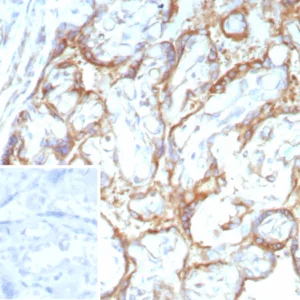 Formalin-fixed, paraffin-embedded human placenta stained with Purified RET Mouse Monoclonal Antibody (RET/8786). Inset: PBS instead of primary antibody; secondary only negative control.