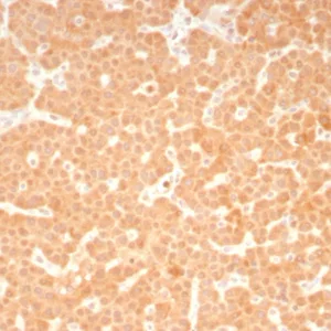 Formalin-fixed, paraffin-embedded human parathyroid stained with RET Mouse Monoclonal Antibody (RET/8787). HIER: Tris/EDTA, pH9.0, 45min. 2°C: HRP-polymer, 30min. DAB, 5min.