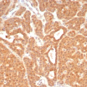 Formalin-fixed, paraffin-embedded human parathyroid stained with RET Mouse Monoclonal Antibody (RET/8789). HIER: Tris/EDTA, pH9.0, 45min. 2°C: HRP-polymer, 30min. DAB, 5min.