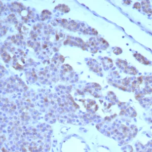 Formalin-fixed, paraffin-embedded human parathyroid stained with RET Mouse Monoclonal Antibody (RET/8791). HIER: Tris/EDTA, pH9.0, 45min. 2°C: HRP-polymer, 30min. DAB, 5min.