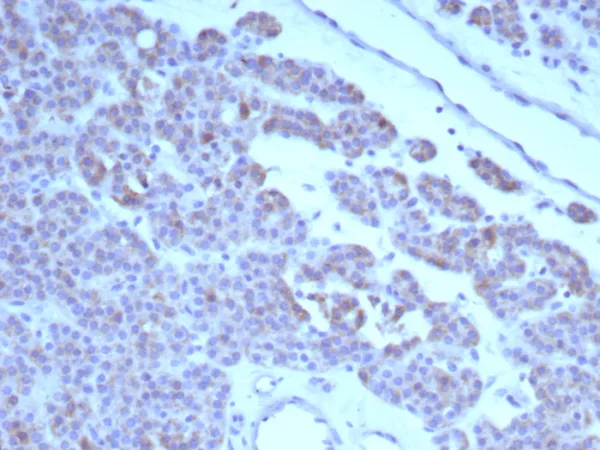 Formalin-fixed, paraffin-embedded human parathyroid stained with RET Mouse Monoclonal Antibody (RET/8791). HIER: Tris/EDTA, pH9.0, 45min. 2°C: HRP-polymer, 30min. DAB, 5min.
