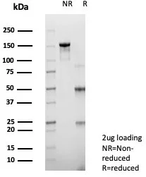 SDS-PAGE Analysis of Purified RET Mouse Monoclonal Antibody (RET/2975). Confirmation of Purity and Integrity of Antibody.