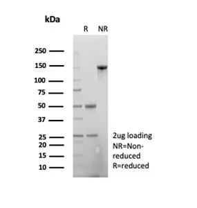 SDS-PAGE Analysis of Purified Beta Actin Mouse Monoclonal (ACTB/2370). Confirmation of Purity and Integrity of Antibody.
