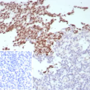 Formalin-fixed, paraffin-embedded human tonsil stained with BCL-6 Rabbit Recombinant Monoclonal Antibody (BCL6/8808R). Inset: PBS instead of primary antibody; secondary only negative control.