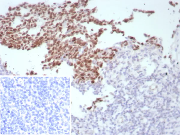 Formalin-fixed, paraffin-embedded human tonsil stained with BCL-6 Rabbit Recombinant Monoclonal Antibody (BCL6/8808R). Inset: PBS instead of primary antibody; secondary only negative control.