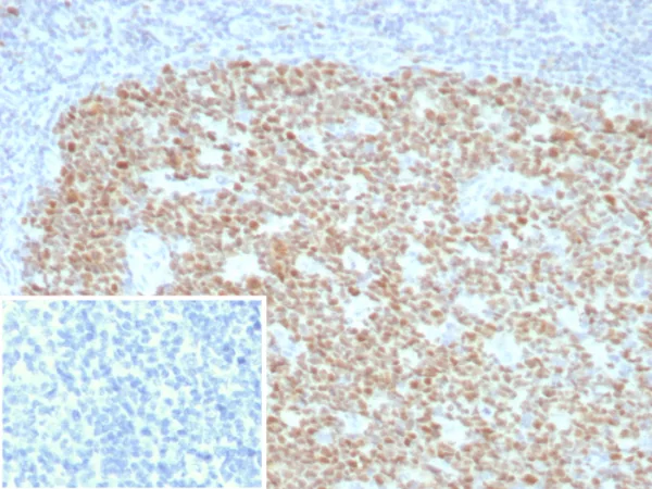 Formalin-fixed, paraffin-embedded human tonsil stained with BCL-6 Rabbit Recombinant Monoclonal Antibody (BCL6/8928R). Inset: PBS instead of primary antibody; secondary only negative control.