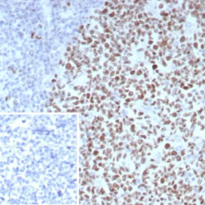 Formalin-fixed, paraffin-embedded human tonsil stained with BCL-6 Rabbit Recombinant Monoclonal Antibody (BCL6/8983R). Inset: PBS instead of primary antibody; secondary only negative control.