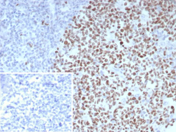 Formalin-fixed, paraffin-embedded human tonsil stained with BCL-6 Rabbit Recombinant Monoclonal Antibody (BCL6/8983R). Inset: PBS instead of primary antibody; secondary only negative control.