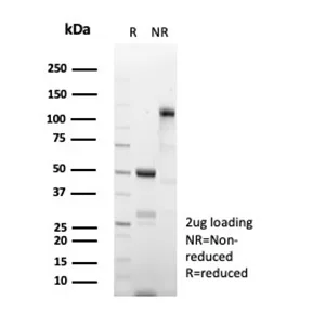 SDS-PAGE Analysis of Purified CD269 Recombinant Rabbit Monoclonal Antibody (CD269/8508R). Confirmation of Purity and Integrity of Antibody.