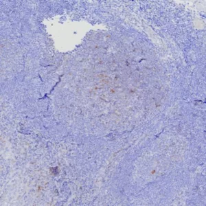 Formalin-fixed, paraffin-embedded human tonsil stained with CD269 Recombinant Rabbit Monoclonal Antibody (CD269/7986R). HIER: Tris/EDTA, pH9.0, 45min. 2°C: HRP-polymer, 30min. DAB, 5min.