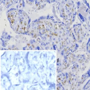 Formalin-fixed, paraffin-embedded human placenta stained with CD269 Recombinant Rabbit Monoclonal Antibody (CD269/8125R). Inset: PBS instead of primary antibody; secondary only negative control.