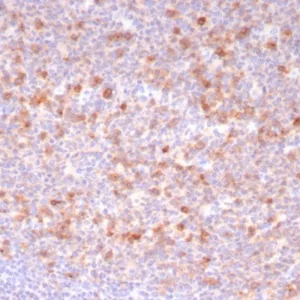 Formalin-fixed, paraffin-embedded human tonsil stained with CD269 Recombinant Rabbit Monoclonal Antibody (CD269/8190R). HIER: Tris/EDTA, pH9.0, 45min. 2°C: HRP-polymer, 30min. DAB, 5min.