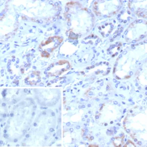 Formalin-fixed, paraffin-embedded human kidney stained with RORC Recombinant Rabbit Monoclonal Antibody (RORC/8017R). Inset: PBS instead of primary antibody; secondary only negative control.