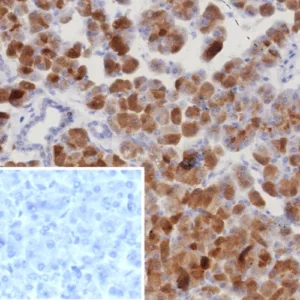 Formalin-fixed, paraffin-embedded human pancreas stained with RORC Recombinant Rabbit Monoclonal Antibody (RORC/8132R). Inset: PBS instead of primary antibody; secondary only negative control.