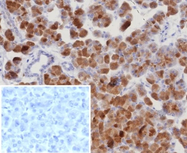 Formalin-fixed, paraffin-embedded human pancreas stained with RORC Recombinant Rabbit Monoclonal Antibody (RORC/8132R). Inset: PBS instead of primary antibody; secondary only negative control.